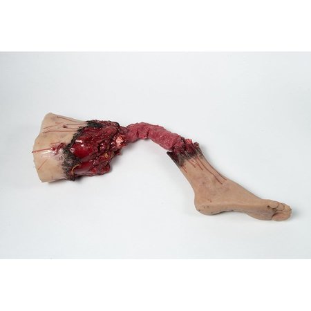 MOULAGE SCIENCE & TRAINING Partial Leg Amputation, Right, Mannequin MST-33-01-R01
